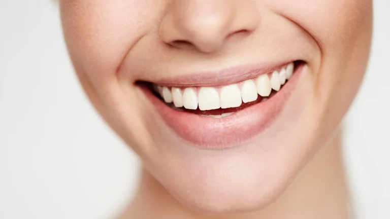 Estetica dental Málaga