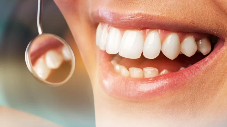 Limpieza dental en Málaga en Carrilero Dental